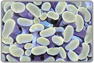 Branch Hammer Coral